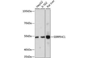 Western blot analysis of extracts of various cell lines, using SERPINC1 Rabbit mAb (ABIN7270208) at 1:1000 dilution. (SERPINC1 antibody)
