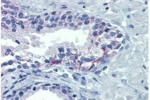 Human Prostate: Formalin-Fixed, Paraffin-Embedded (FFPE) (OR51E1 antibody  (AA 79-141))