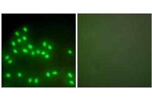 Immunofluorescence analysis of A549 cells, using Ku70/80 antibody (ABIN5976447). (XRCC5 antibody  (C-Term))