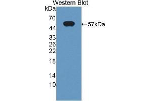 Western Blotting (WB) image for anti-Chymotrypsin C (Caldecrin) (CTRC) (AA 30-268) antibody (ABIN1867735) (Elastase 4 antibody  (AA 30-268))