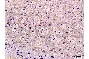Formalin-fixed and paraffin embedded rat brain labeled with Anti-Thrap3/TRAP150 Polyclonal Antibody, Unconjugated (ABIN1387545) at 1:200 followed by conjugation to the secondary antibody and DAB staining (THRAP3 antibody  (AA 631-730))