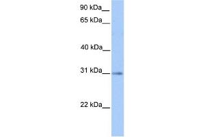 WB Suggested Anti-HAGH Antibody Titration: 0. (HAGH antibody  (C-Term))