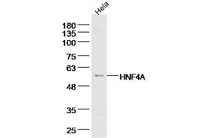 Hela lysates probed with TRAF2 Polyclonal Antibody, Unconjugated  at 1:300 dilution and 4˚C overnight incubation. (TRAF2 antibody  (AA 401-501))