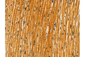 ABIN6261761 and ABIN6266840 at 1/100 staining Rat heart tissue by IHC-P.
