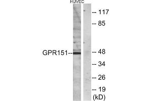 Western blot analysis of extracts from HUVEC cells, using GPR151 antibody. (GPR151 antibody  (C-Term))