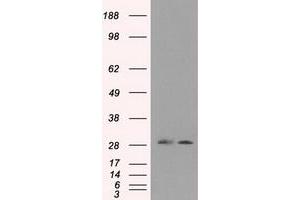 Image no. 1 for anti-Replication Protein A2, 32kDa (RPA2) antibody (ABIN1500734) (RPA2 antibody)