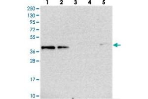 Western blot analysis of Lane 1: RT-4, Lane 2: U-251 MG, Lane 3: Human Plasma, Lane 4: Liver, Lane 5: Tonsil with TMEM164 polyclonal antibody  at 1:250-1:500 dilution. (TMEM164 antibody)