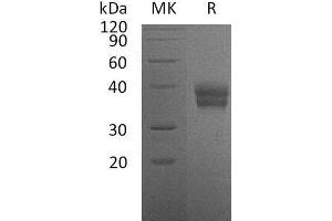 CA12 Protein (His tag)