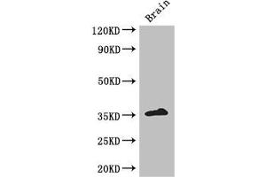 Western Blot Positive WB detected in: Mouse brain tissue All lanes: ZFP42 antibody at 3 μg/mL Secondary Goat polyclonal to rabbit IgG at 1/50000 dilution Predicted band size: 35 kDa Observed band size: 35 kDa (ZFP42 antibody  (AA 6-68))