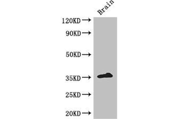 ZFP42 antibody  (AA 6-68)