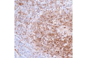 Immunohistochemistry (IHC) image for anti-HLA-DR-gamma (CD74) antibody (ABIN7449435) (CD74 antibody)