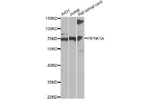 Western blot analysis of extracts of various cell lines, using PIP5K1A antibody (ABIN6292233) at 1:1000 dilution.