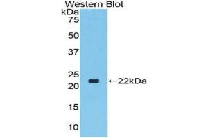Western blot analysis of the recombinant protein. (TLR7 antibody  (AA 887-1036))