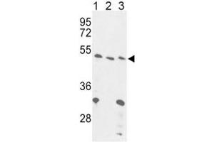 Western blot analysis of FOXP3 antibody and (1) 293, (2) Jurkat and (3) mouse liver lysate. (FOXP3 antibody  (AA 283-311))