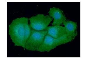 ICC/IF analysis of VTA1 in Hep3B cells line, stained with DAPI (Blue) for nucleus staining and monoclonal anti-human VTA1 antibody (1:100) with goat anti-mouse IgG-Alexa fluor 488 conjugate (Green). (VTA1 antibody)