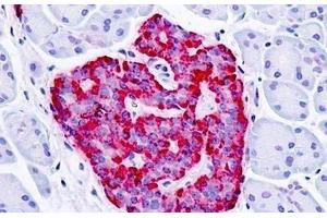 Human, Pancreas, Islet: Formalin-Fixed Paraffin-Embedded (FFPE) (GPER antibody  (Cytoplasmic Domain))