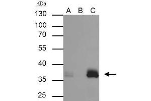 IP Image Apolipoprotein E antibody [C2C3], C-term immunoprecipitates Apolipoprotein E protein in IP experiments.
