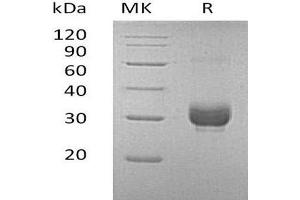 Western Blotting (WB) image for Noggin (NOG) protein (His tag) (ABIN7320797) (NOG Protein (His tag))