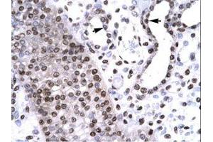 Image no. 1 for anti-BarH-Like Homeobox 2 (BARHL2) (AA 165-214) antibody (ABIN6735794) (BARHL2 antibody  (AA 165-214))