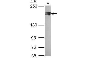 WB Image Sample (30 ug of whole cell lysate) A: A431 , 5% SDS PAGE PB1 antibody antibody diluted at 1:500 (Polybromo 1 antibody  (N-Term))