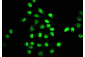 Immunofluorescence staining of A549 cells with ABIN7172758 at 1:147, counter-stained with DAPI. (TEAD1 antibody  (AA 135-215))