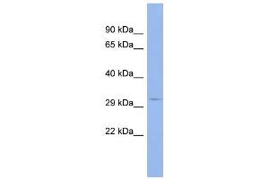 WB Suggested Anti-MSI2 Antibody Titration:  0. (MSI2 antibody  (Middle Region))