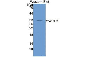 Western blot analysis of the recombinant protein. (RGS19 antibody  (AA 1-217))