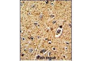 Immunohistochemistry (Paraffin-embedded Sections) (IHC (p)) image for anti-Tryptophan Hydroxylase 1 (TPH1) (AA 35-62), (N-Term) antibody (ABIN390917)