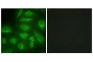 Immunofluorescence analysis of HeLa cells, using DGKI antibody. (DGKI antibody  (C-Term))