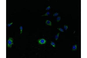 Immunofluorescent analysis of HepG2 cells using ABIN7166799 at dilution of 1:100 and Alexa Fluor 488-congugated AffiniPure Goat Anti-Rabbit IgG(H+L) (SVOPL antibody  (AA 73-129))