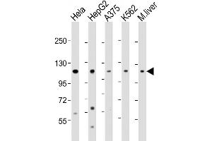 Western Blot at 1:2000 dilution Lane 1: Hela whole cell lysate Lane 2: HepG2 whole cell lysate Lane 3: A375 whole cell lysate Lane 4: K562 whole cell lysate Lane 5: mouse liver lysate Lysates/proteins at 20 ug per lane. (IDE antibody  (AA 406-435))