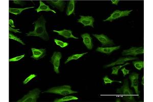Immunofluorescence of monoclonal antibody to FABP4 on HeLa cell. (FABP4 antibody  (AA 1-132))