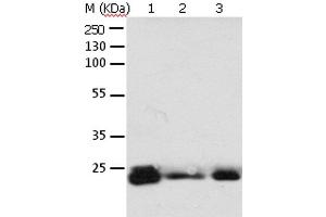 Western Blot analysis of 293T cell and Mouse brain tissue, A549, Hela, A172 and HT-29 cell using RAB6A Polyclonal Antibody at dilution of 1:650 (RAB6A antibody)