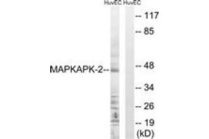 Western blot analysis of extracts from HuvEc cells, treated with Adriamycin 0. (MAPKAP Kinase 2 antibody  (AA 188-237))