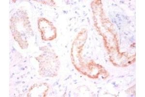 Immunohistochemistry of paraffin-embedded human kidney tissue using ABIN7146207 at dilution of 1:50 (Cadherin 12 antibody  (AA 56-605))