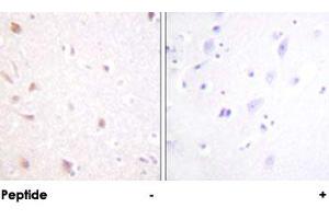 Immunohistochemical analysis of paraffin-embedded human brain tissue using MKI67IP polyclonal antibody .