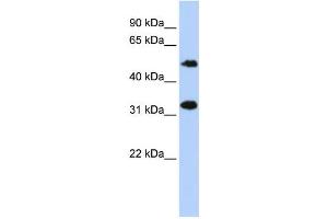 Western Blotting (WB) image for anti-Chromosome 6 Open Reading Frame 150 (C6orf150) antibody (ABIN2459547) (C6orf150 antibody)