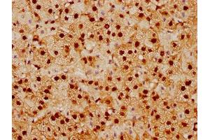 Immunohistochemistry (IHC) image for anti-Small Ubiquitin Related Modifier Protein 1 (SUMO1) antibody (ABIN7127830)