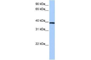 ZNF618 antibody used at 0. (ZNF618 antibody  (N-Term))