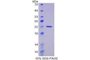 SDS-PAGE (SDS) image for Prostaglandin D2 Synthase (PTGDS) (AA 32-190) protein (His tag) (ABIN2126444)