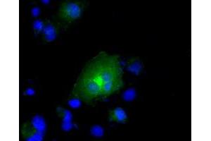 Image no. 2 for anti-Ring Finger Protein 144B (RNF144B) (AA 1-256) antibody (ABIN1490644) (RNF144B antibody  (AA 1-256))