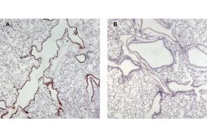 ABIN185677 (0. (UNC13D antibody  (Internal Region))