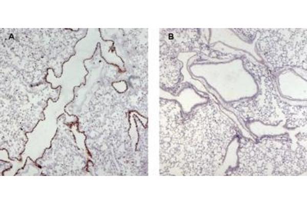 UNC13D antibody  (Internal Region)