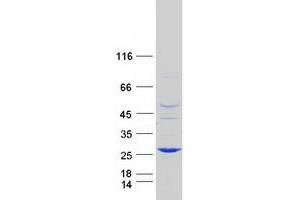 Validation with Western Blot (ABHD14B Protein (Myc-DYKDDDDK Tag))