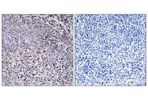 Immunohistochemistry (IHC) image for anti-Holocytochrome C Synthase (HCCS) (Internal Region) antibody (ABIN1850244) (HCCS antibody  (Internal Region))