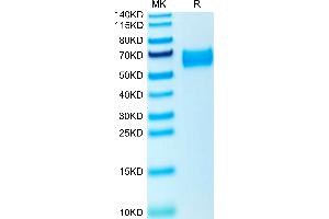 ROBO4 Protein (AA 27-469) (His tag)