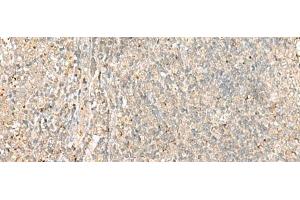 Immunohistochemistry of paraffin-embedded Human tonsil tissue using EIF2AK1 Polyclonal Antibody at dilution of 1:45(x200) (EIF2AK1 antibody)