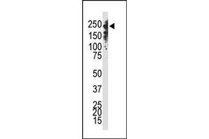 The anti-Dnmt1 C-term Pab (ABIN387878 and ABIN2844085) is used in Western blot to detect Dnmt1 in Jurkat cell lysate. (DNMT1 antibody  (C-Term))