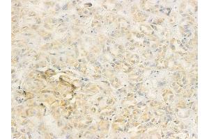 anti-P53 and DNA-Damage Regulated 1 (PDRG1) (Internal Region) antibody