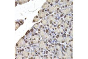 Immunohistochemistry of paraffin-embedded rat pancreas using LMNB2 antibody at dilution of 1:200 (400x lens). (Lamin B2 antibody)